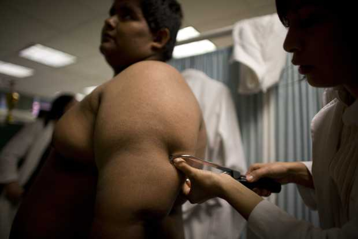 La obesidad genera pérdida de productividad con costo de 25 mil millones de pesos en el país. La obesidad genera pérdida de productividad con costo de 25 mil millones de pesos en el país.