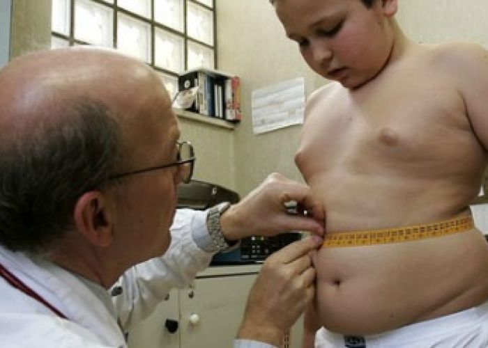 Hoy México podría invertir 544 pesos por persona obesa para combatir el problema, de 152 pesos que recomienda la OCDE.