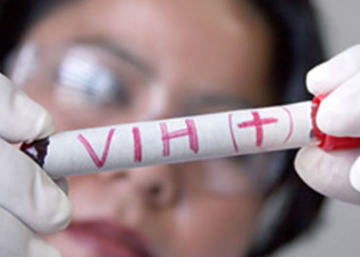 Los británicos obtienen resultados positivos de lo que podría ser el inicio de la cura del VIH positivo