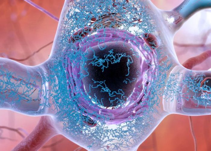 Acumulaciones de la proteína tau dañan las conexions sinápticas de las neuronas, causando pérdida de memoria. Imagen: National Institute of Aging.