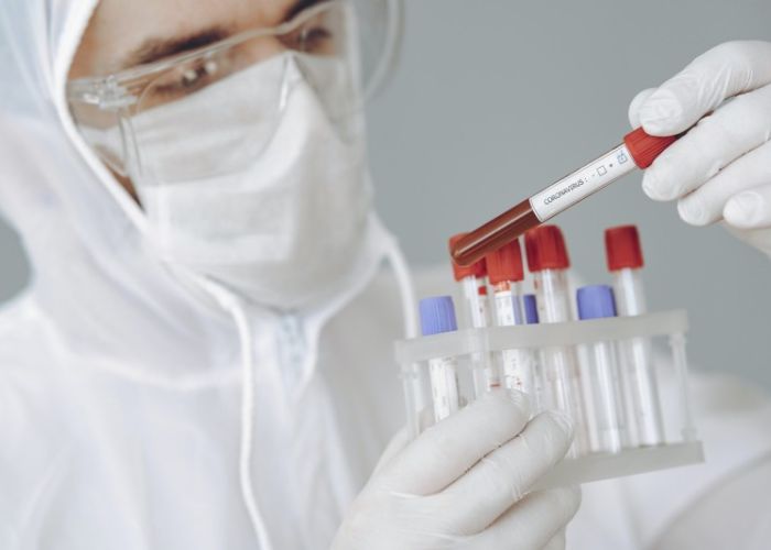 The Lancet publicó este lunes que dos posibles vacunas contra el virus que investigan la Universidad de Oxford y AstraZeneca, así como la compañía china CanSino Biologics han pasado favorablemente la Fase II provocando respuestas inmunes, sin efectos secundarios peligrosos.