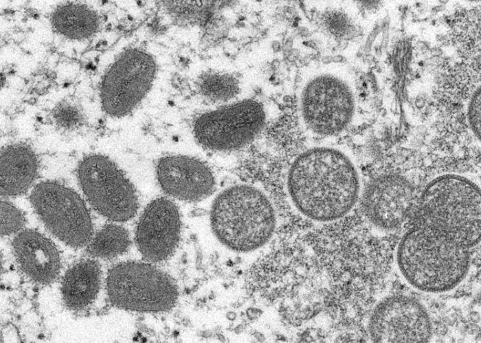 Esta imagen de un microscopio electrónico, proporcionada el miércoles 18 de mayo de 2022 por los Centros para el Control y la Prevención de Enfermedades (CDC, por sus siglas en inglés) de Estados Unidos, muestra viriones maduros de viruela símica, de forma ovalada (izquierda) y viriones inmaduros esféricos (derecha), obtenidos de una muestra de piel humana vinculada con un brote de 2003. (Foto:Cynthia S. Goldsmith, Russell Regner/CDC vía AP)