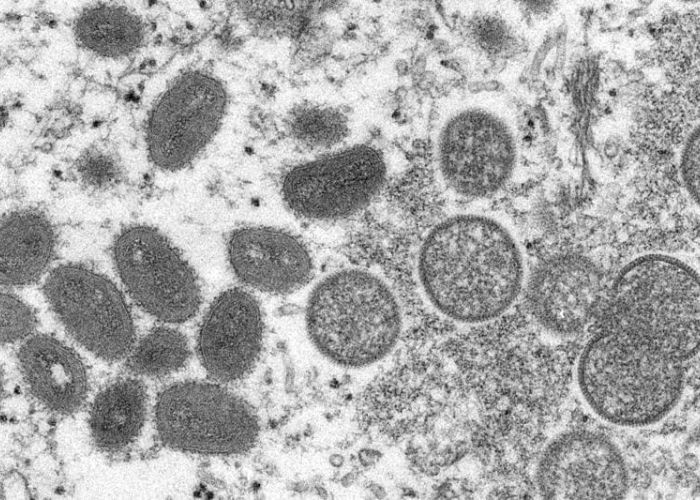 Esta imagen de un microscopio electrónico, proporcionada el miércoles 18 de mayo de 2022 por los Centros para el Control y la Prevención de Enfermedades (CDC, por sus siglas en inglés) de Estados Unidos, muestra viriones maduros de viruela símica, de forma ovalada (izquierda) y viriones inmaduros esféricos (derecha), obtenidos de una muestra de piel humana vinculada con un brote de 2003. (Foto:Cynthia S. Goldsmith, Russell Regner/CDC vía AP)